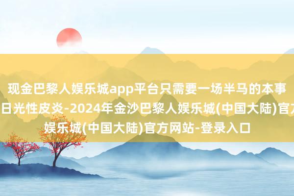 现金巴黎人娱乐城app平台只需要一场半马的本事就够了其实我有日光性皮炎-2024年金沙巴黎人娱乐城(中国大陆)官方网站-登录入口